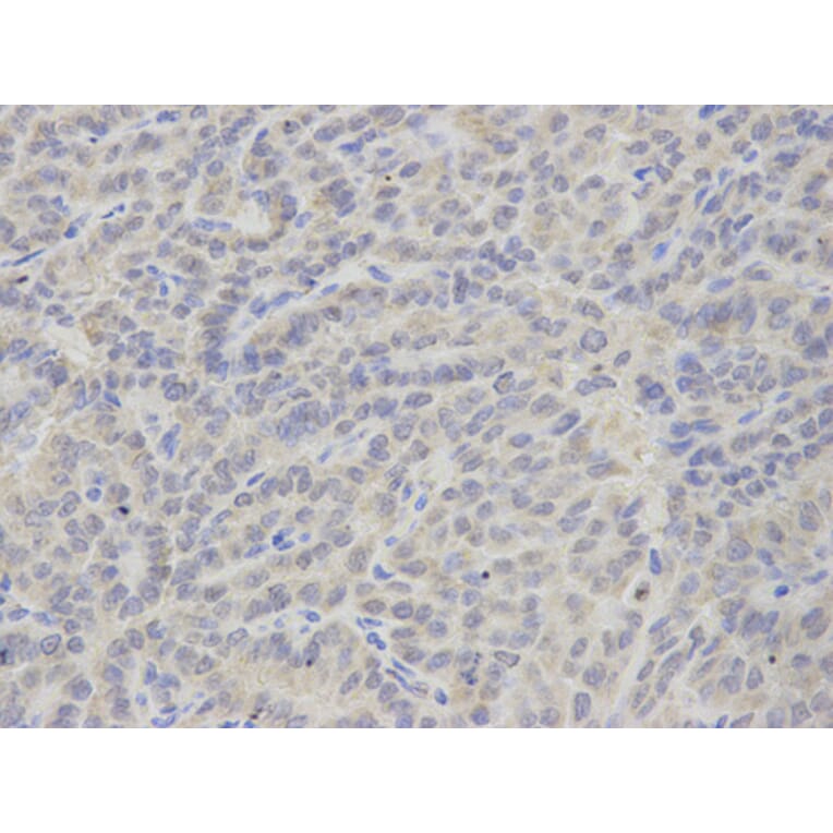 Anti-TXA synthase Antibody from Bioworld Technology (BS7276) - Antibodies.com