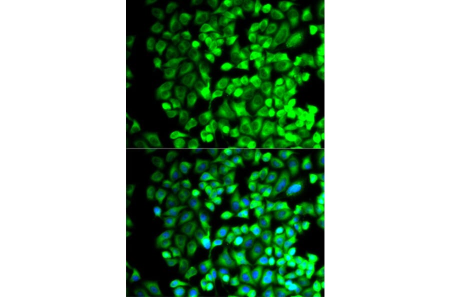 Anti-TXA synthase Antibody from Bioworld Technology (BS7276) - Antibodies.com