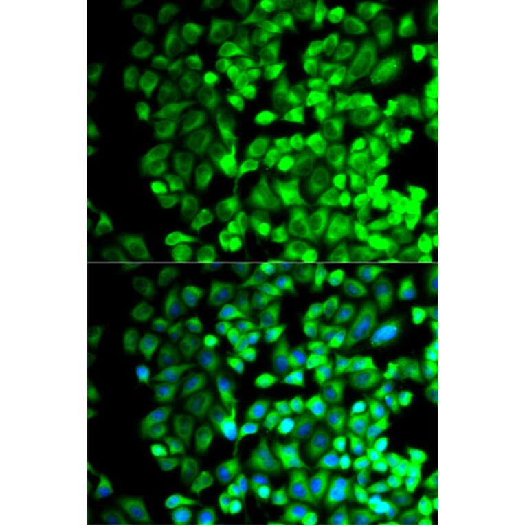 Anti-TXA synthase Antibody from Bioworld Technology (BS7276) - Antibodies.com
