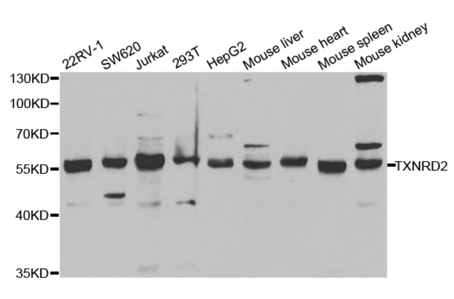 Anti-TXNRD2 Antibody from Bioworld Technology (BS7277) - Antibodies.com