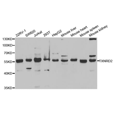 Anti-TXNRD2 Antibody from Bioworld Technology (BS7277) - Antibodies.com