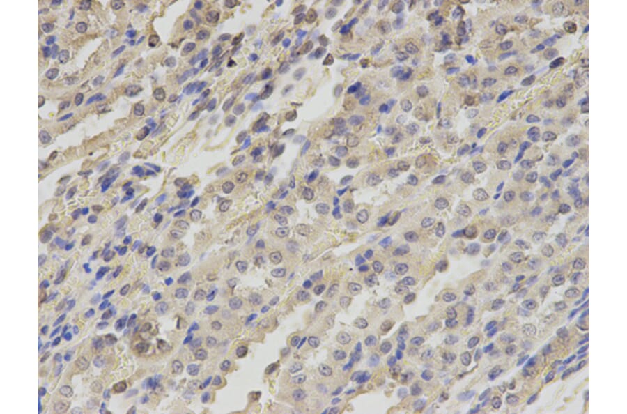 Anti-TXNRD2 Antibody from Bioworld Technology (BS7277) - Antibodies.com