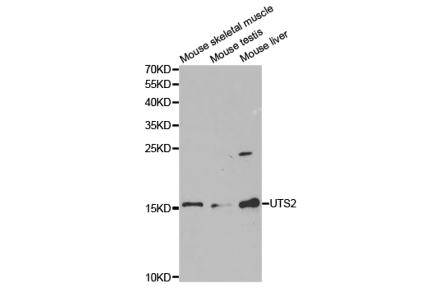 Anti-Urotensin II Antibody from Bioworld Technology (BS7278) - Antibodies.com