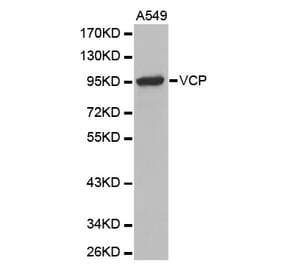 Anti-VCP Antibody from Bioworld Technology (BS7279) - Antibodies.com