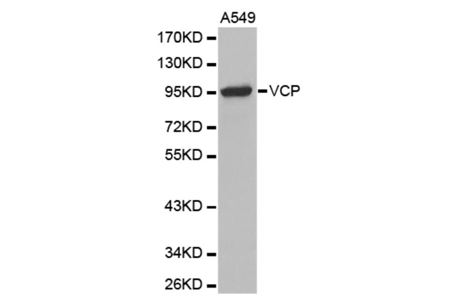 Anti-VCP Antibody from Bioworld Technology (BS7279) - Antibodies.com