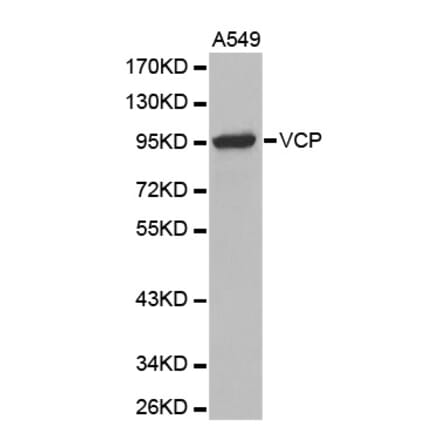 Anti-VCP Antibody from Bioworld Technology (BS7279) - Antibodies.com