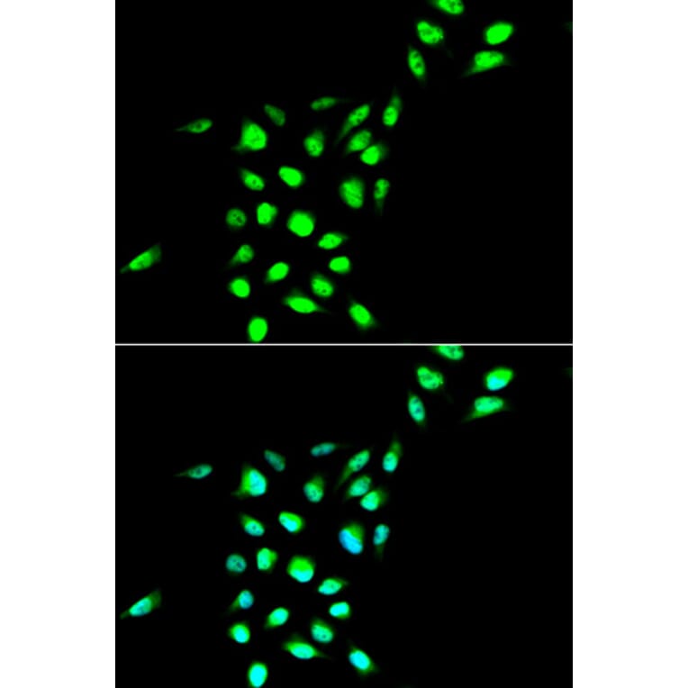Anti-VCP Antibody from Bioworld Technology (BS7279) - Antibodies.com