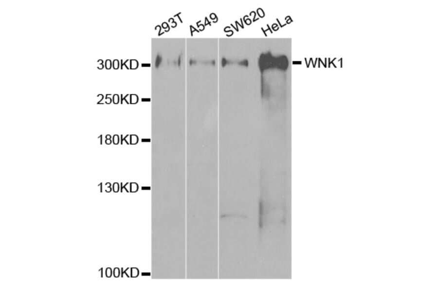 Anti-WNK1 Antibody from Bioworld Technology (BS7281) - Antibodies.com