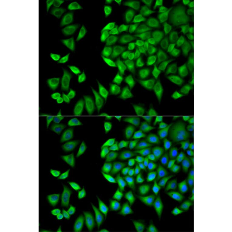 Anti-WNK1 Antibody from Bioworld Technology (BS7281) - Antibodies.com