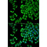 Anti-WNK1 Antibody from Bioworld Technology (BS7281) - Antibodies.com