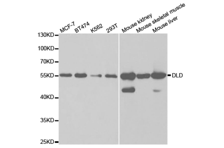 Anti-DLD Antibody from Bioworld Technology (BS7282) - Antibodies.com