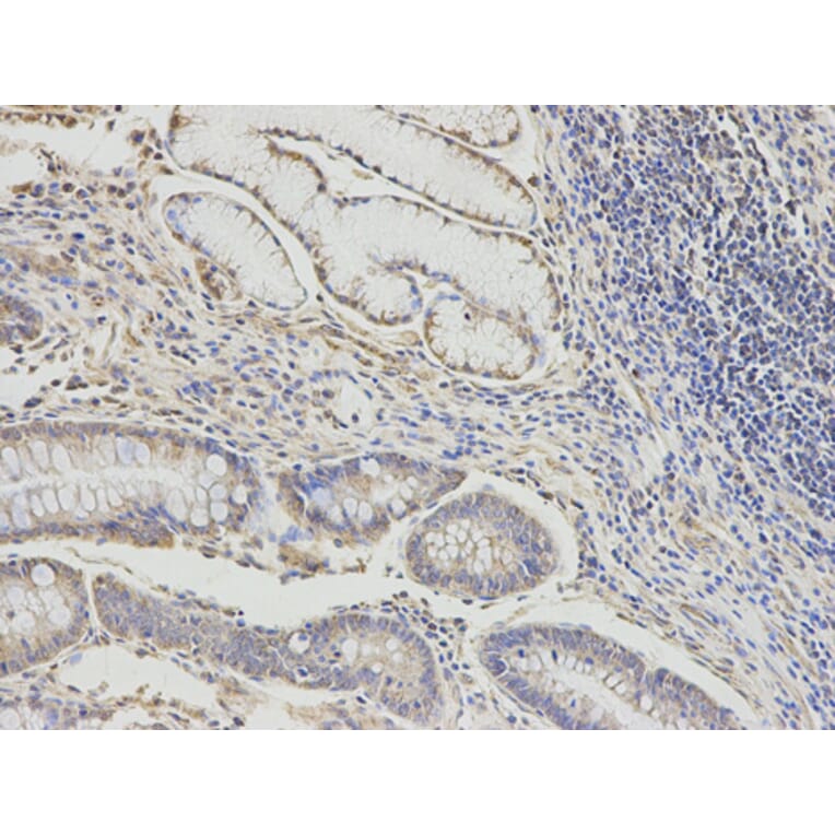 Anti-DLD Antibody from Bioworld Technology (BS7282) - Antibodies.com