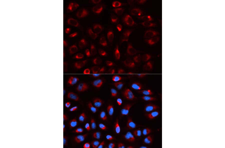 Anti-DLD Antibody from Bioworld Technology (BS7282) - Antibodies.com