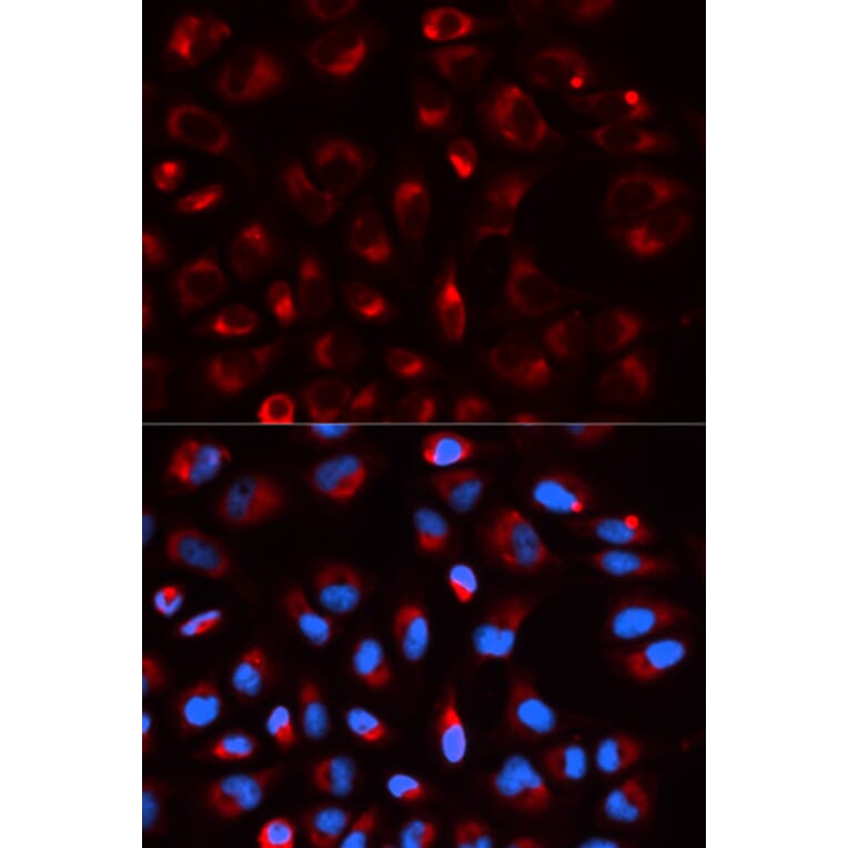 Anti-DLD Antibody from Bioworld Technology (BS7282) - Antibodies.com