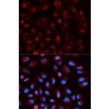 Anti-DLD Antibody from Bioworld Technology (BS7282) - Antibodies.com