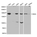 Anti-SIN3A Antibody from Bioworld Technology (BS7283) - Antibodies.com