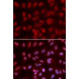 Anti-SIN3A Antibody from Bioworld Technology (BS7283) - Antibodies.com