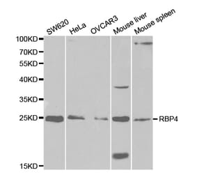 Anti-RBP4 Antibody from Bioworld Technology (BS7285) - Antibodies.com