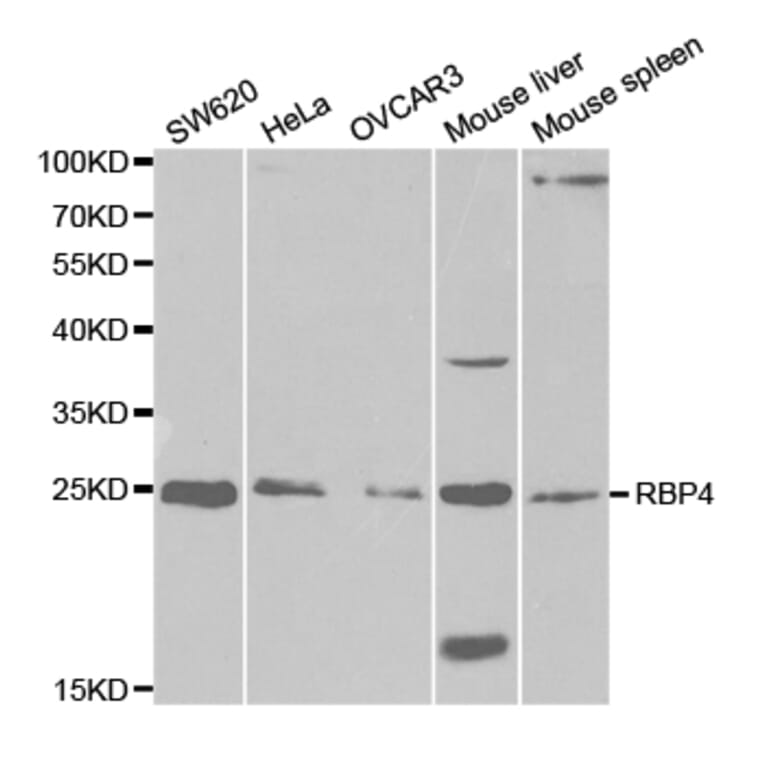 Anti-RBP4 Antibody from Bioworld Technology (BS7285) - Antibodies.com