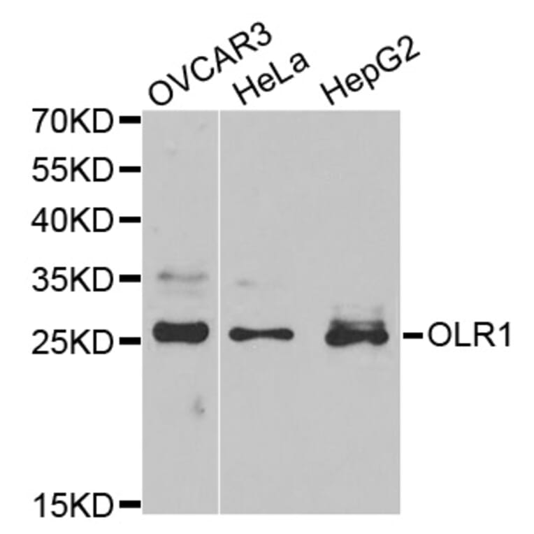 Anti-OLR1 Antibody from Bioworld Technology (BS7287) - Antibodies.com