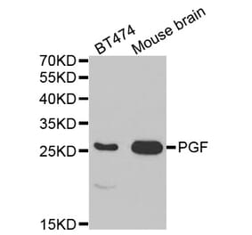 Anti-PGF Antibody from Bioworld Technology (BS7291) - Antibodies.com