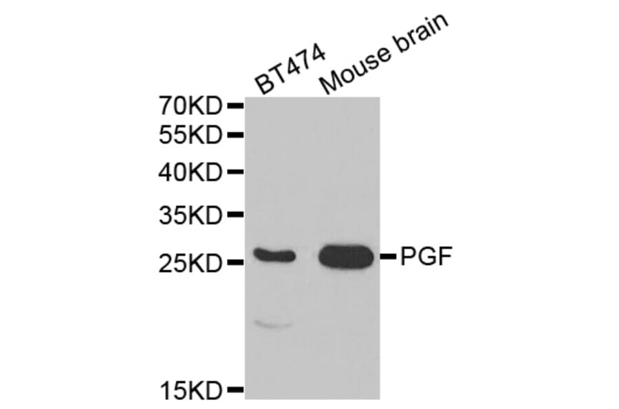 Anti-PGF Antibody from Bioworld Technology (BS7291) - Antibodies.com