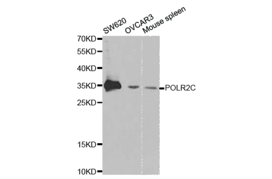 Anti-POLR2C Antibody from Bioworld Technology (BS7292) - Antibodies.com