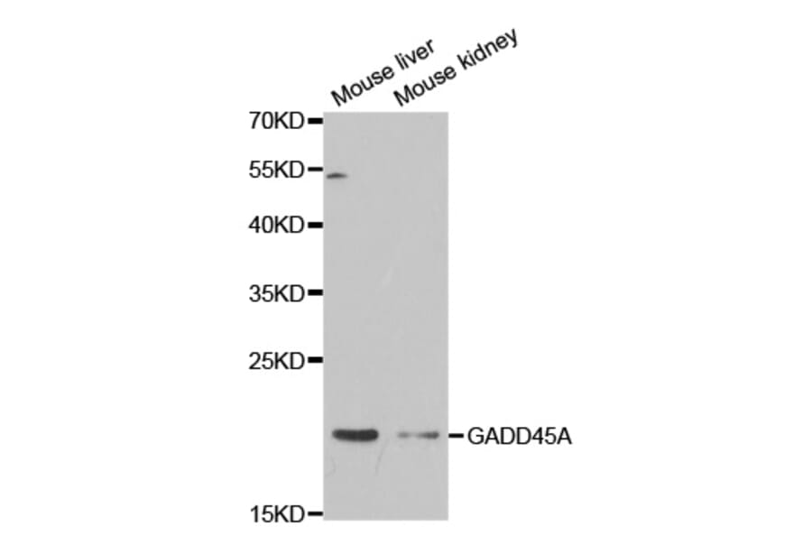 Anti-GADD45A Antibody from Bioworld Technology (BS7294) - Antibodies.com