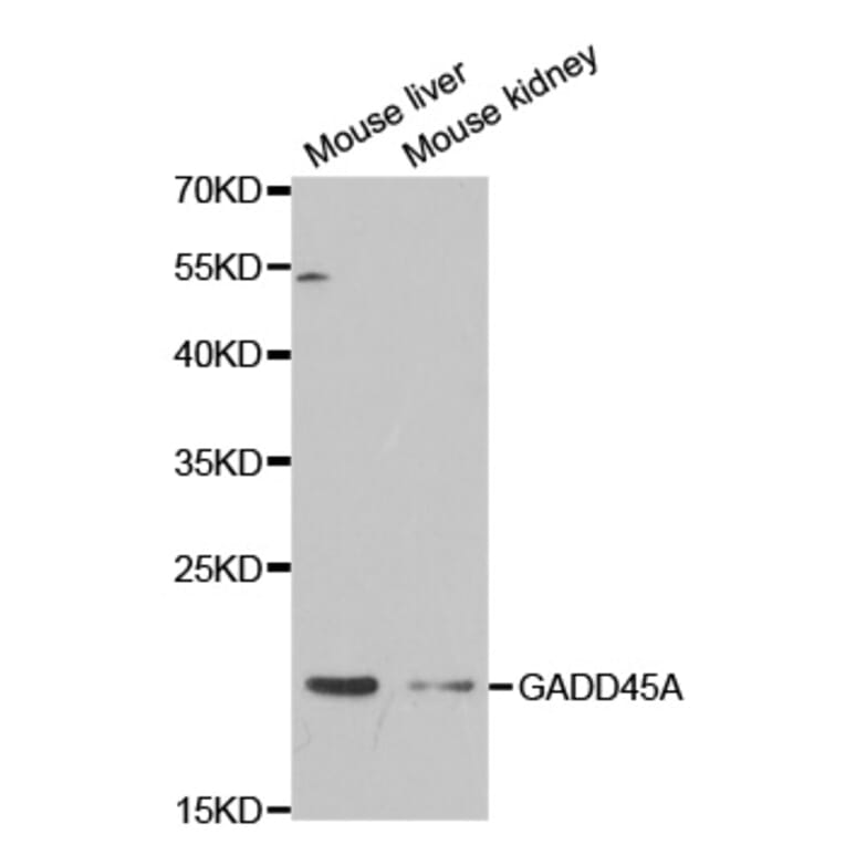 Anti-GADD45A Antibody from Bioworld Technology (BS7294) - Antibodies.com