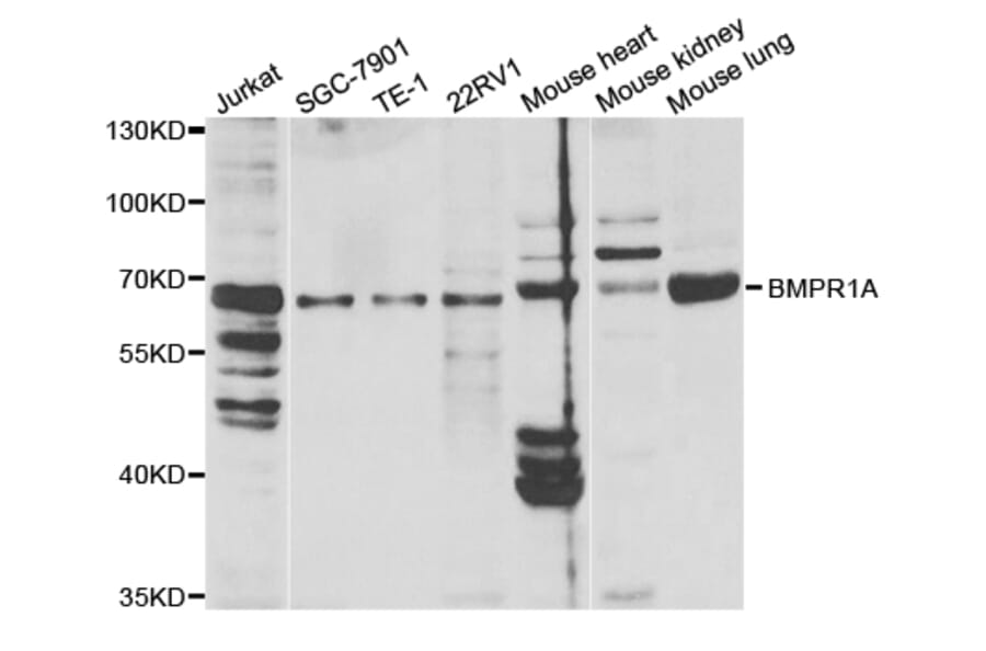 Anti-BMPR1A Antibody from Bioworld Technology (BS7295) - Antibodies.com