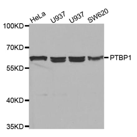 Anti-PTBP1 Antibody from Bioworld Technology (BS7296) - Antibodies.com