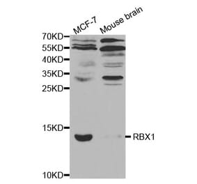 Anti-RBX1 Antibody from Bioworld Technology (BS7297) - Antibodies.com