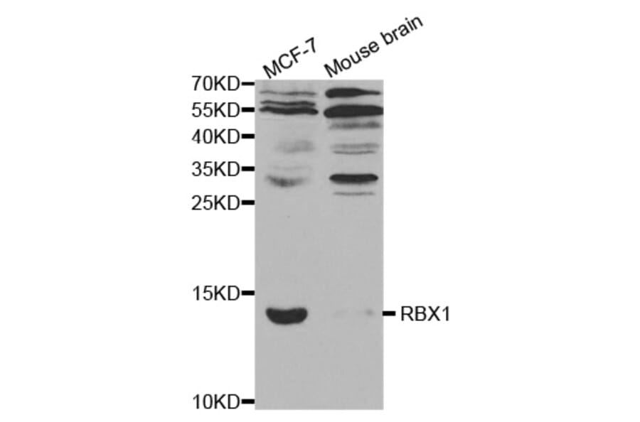 Anti-RBX1 Antibody from Bioworld Technology (BS7297) - Antibodies.com