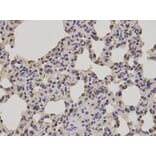 Anti-PRDX1 Antibody from Bioworld Technology (BS7300) - Antibodies.com