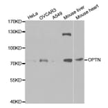 Anti-OPTN Antibody from Bioworld Technology (BS7301) - Antibodies.com