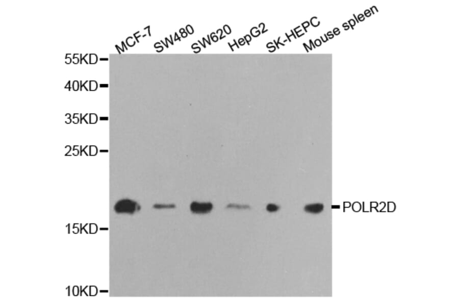 Anti-POLR2D Antibody from Bioworld Technology (BS7304) - Antibodies.com