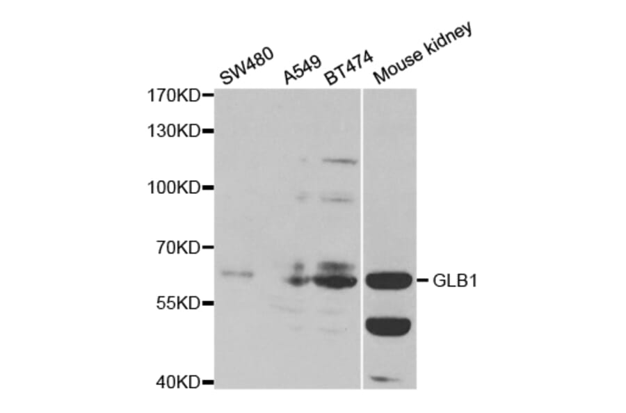 Anti-GLB1 Antibody from Bioworld Technology (BS7306) - Antibodies.com