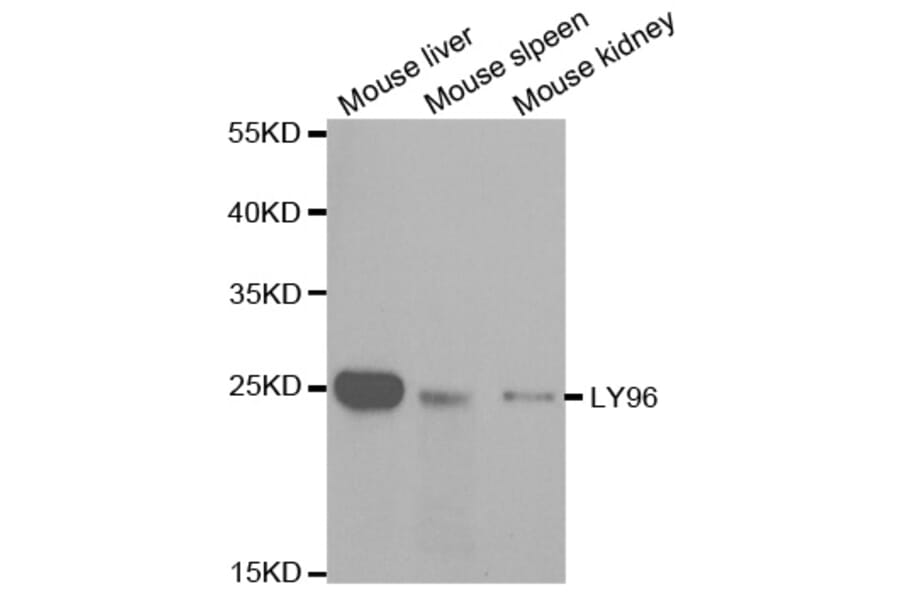 Anti-LY96 Antibody from Bioworld Technology (BS7308) - Antibodies.com