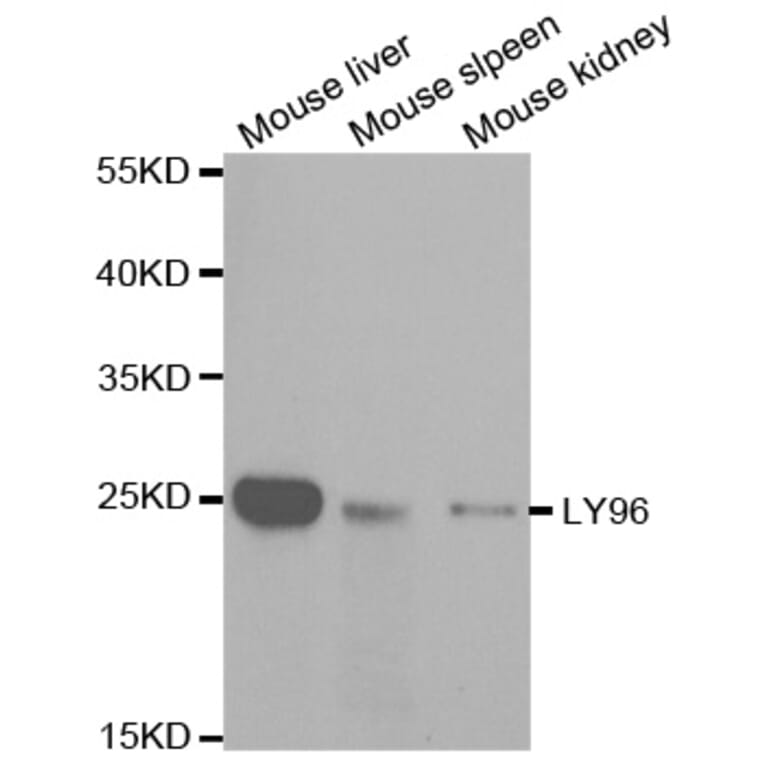 Anti-LY96 Antibody from Bioworld Technology (BS7308) - Antibodies.com