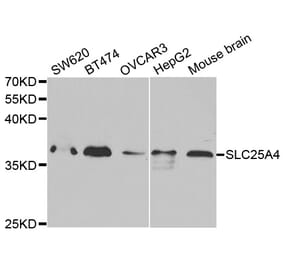 Anti-SLC25A4 Antibody from Bioworld Technology (BS7310) - Antibodies.com