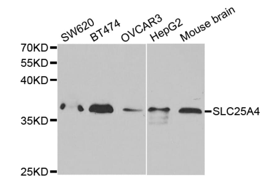 Anti-SLC25A4 Antibody from Bioworld Technology (BS7310) - Antibodies.com
