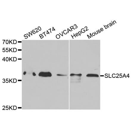 Anti-SLC25A4 Antibody from Bioworld Technology (BS7310) - Antibodies.com