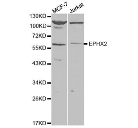 Anti-EPHX2 Antibody from Bioworld Technology (BS7311) - Antibodies.com