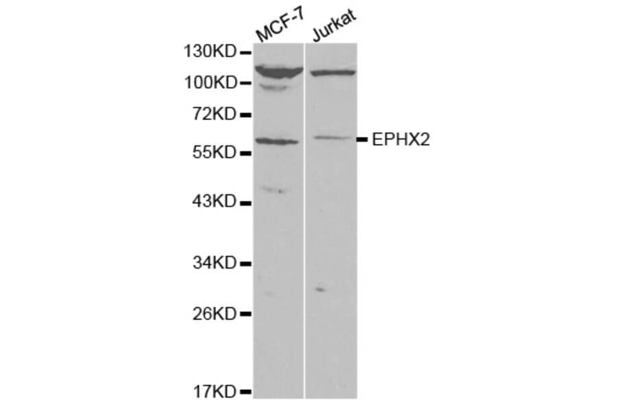 Anti-EPHX2 Antibody from Bioworld Technology (BS7311) - Antibodies.com