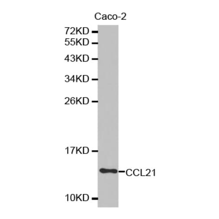 Anti-CCL21 Antibody from Bioworld Technology (BS7312) - Antibodies.com