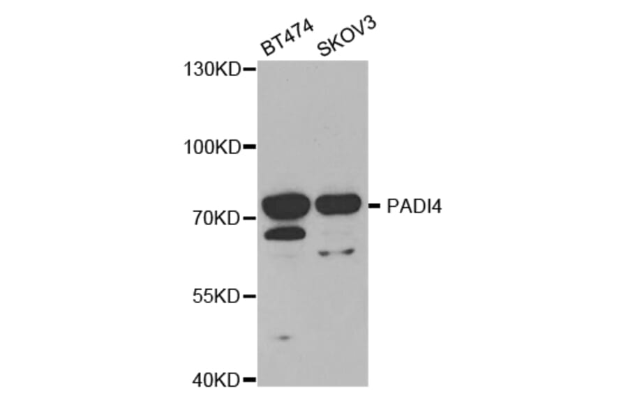 Anti-PADI4 Antibody from Bioworld Technology (BS7314) - Antibodies.com