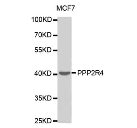 Anti-PPP2R4 Antibody from Bioworld Technology (BS7316) - Antibodies.com