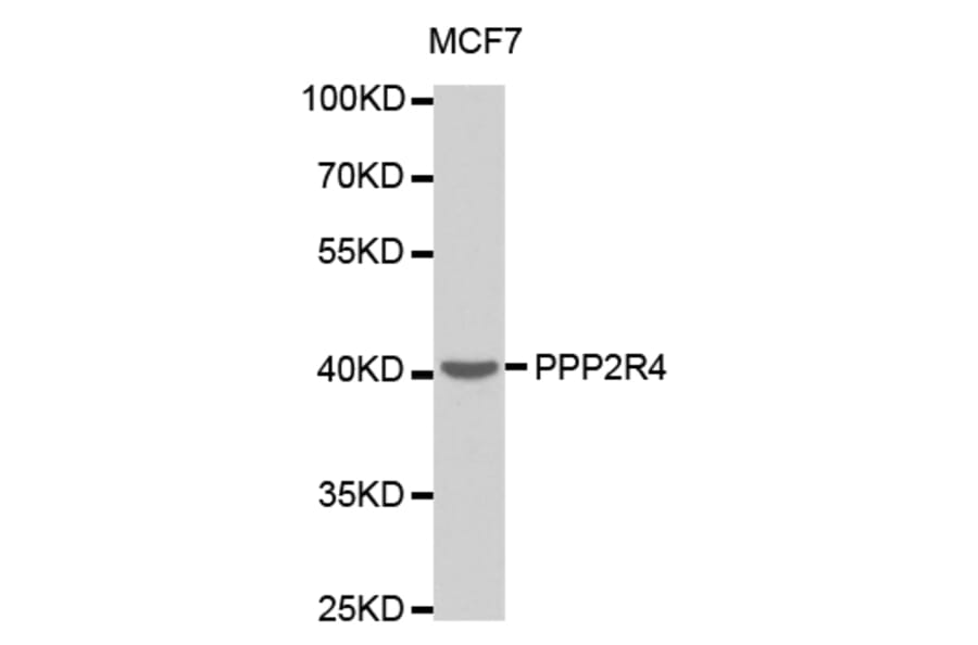 Anti-PPP2R4 Antibody from Bioworld Technology (BS7316) - Antibodies.com