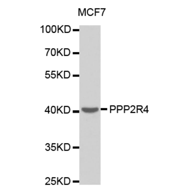 Anti-PPP2R4 Antibody from Bioworld Technology (BS7316) - Antibodies.com