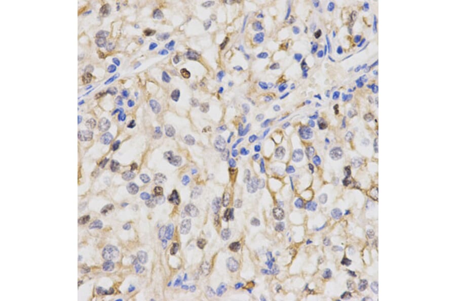Anti-PPP2R4 Antibody from Bioworld Technology (BS7316) - Antibodies.com